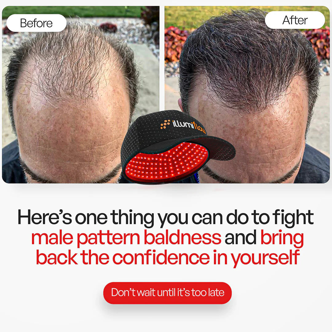 272 Laser Hair Regrowth Cap – Doctor-Recommended, FDA-Cleared, 6-Month Guarantee